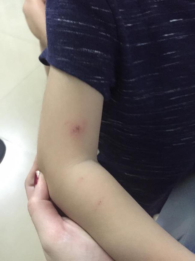 Phụ huynh bức xúc tố cô giáo trường MN quốc tế đánh con gái 3 tuổi trầy xước khắp người - Ảnh 3.