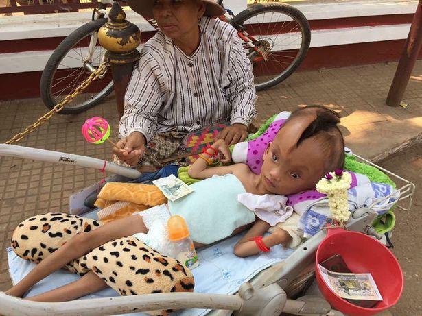 Bé trai đáng thương bị nứt đôi đầu mà không rõ nguyên do - Ảnh 1.