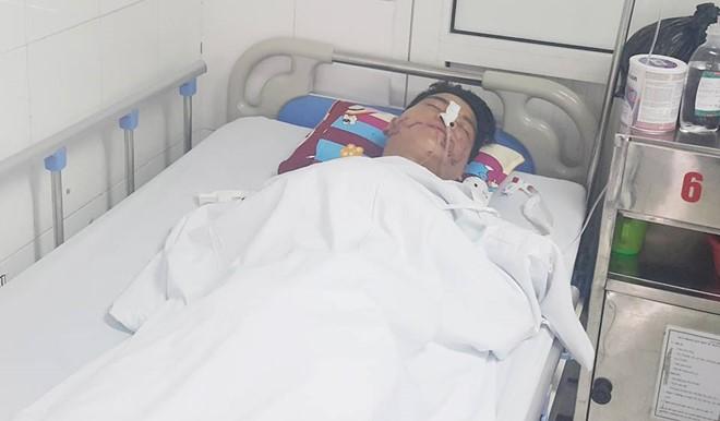 Dien vien xiec bi dap nat mat khi cho dau vao mieng ca sau hinh anh 1