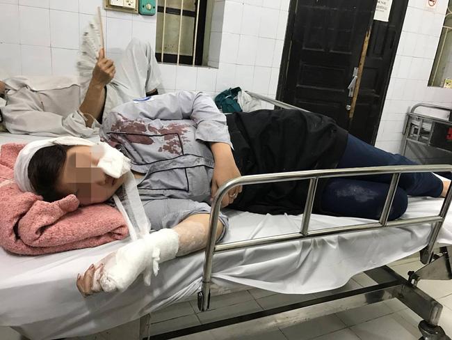 Hà Nội: Nữ sinh lớp 10 bàng hoàng kể lại phút bị nhóm thanh niên vây đánh chảy máu đầu - Ảnh 1.