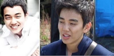 Chiếc răng khểnh đủ giúp Yoo Seung Ho thêm phần soái ca nhưng nam diễn viên vẫn quyết định loại bỏ chúng.