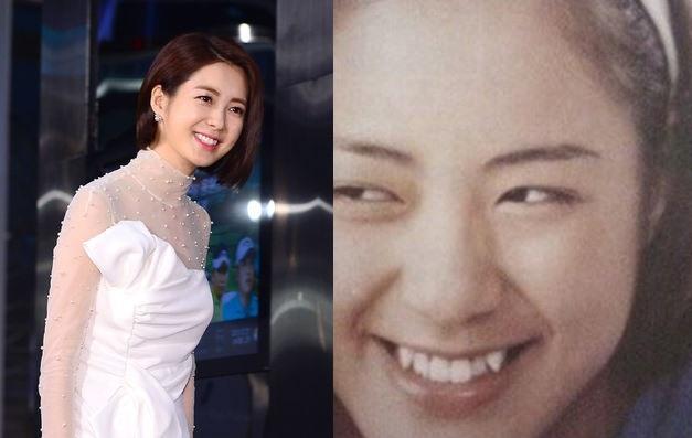 Nữ hoàng Seon Deok - Lee Ye Won tự tin cười tươi khi đã loại bỏ 2 chiếc răng "tranh nhau làm tổ trưởng" kia.