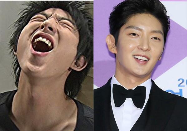 Với nụ cười như thế này thì Lee Jun Ki sửa răng là việc hoàn toàn đúng đắn!