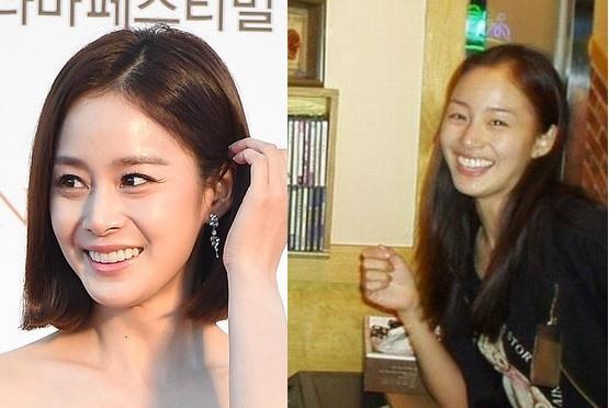 Trong loạt ảnh "dìm hàng" này, nữ thần Kim Tae Hee vẫn là người giữ được hình tượng nhất khi nhan sắc của cô không thay đổi là bao sau khi chỉnh sửa hàm răng.