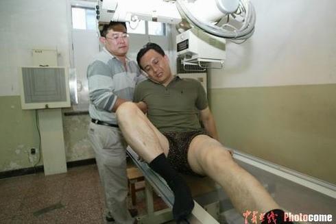 Truong Ve Kien va be boi danh tai tu 'Tay du ky' gay xuong, dap than hinh anh 1