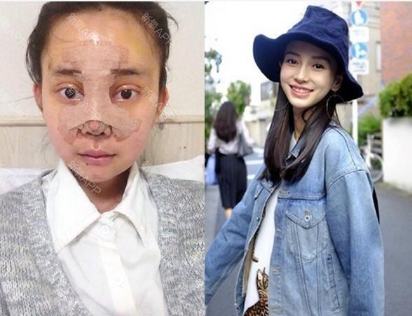Mẫu Hàn chi hàng tỷ đồng để thẩm mỹ giống Angela Baby, cuối cùng lại được nhận xét là giống... Yoona - Ảnh 3.