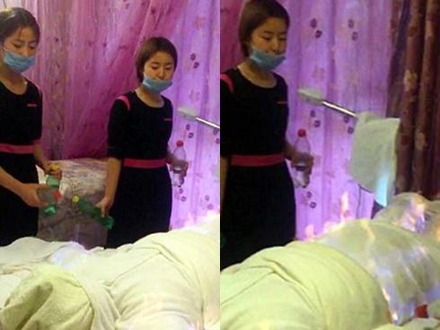 Sốc với trò giảm cân kỳ quái: Quấn chặt người như xác ướp rồi dùng lửa đốt