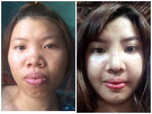 Diện mạo mới của bà mẹ đơn thân ở Đắk Nông quyết đi phẫu thuật vì quá xấu