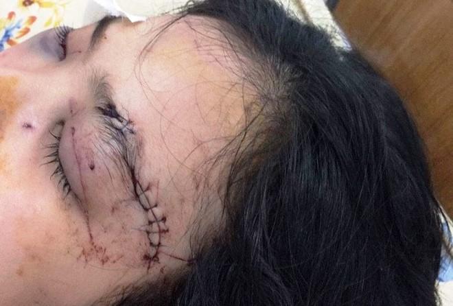 Nu chu muu cat tai thieu nu 16 tuoi o Sai Gon khai gi? hinh anh 1