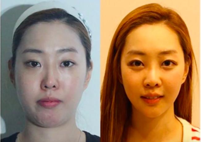 Con gái và những pha lột xác ngoạn mục nhờ phẫu thuật thẩm mỹ! - Ảnh 3.