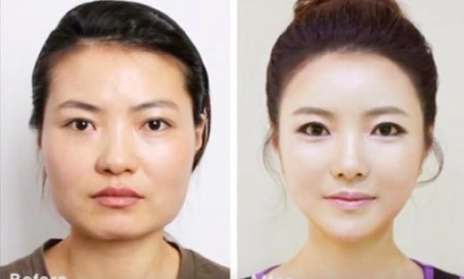 Con gái và những pha lột xác ngoạn mục nhờ phẫu thuật thẩm mỹ! - Ảnh 5.