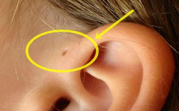 Sở hữu những đặc điểm này, bạn là một trong những người đặc biệt trên thế giới - Ảnh 6.