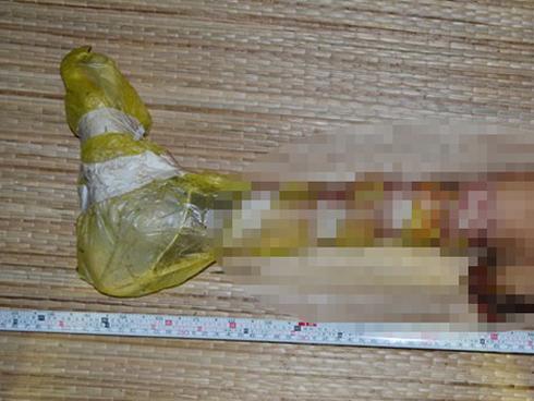 Phát hiện cẳng chân người trong túi nylon tại bãi rác lớn nhất Trà Vinh