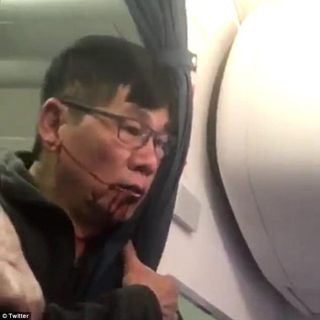 Xác nhận bác sĩ châu Á bị lôi khỏi máy bay United Airlines là người gốc Việt - Ảnh 1.