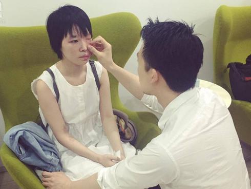 Tin hot trong ngày: Hình ảnh sau cấy da của cô gái bị bạn tạt axit bỏng đến 75% gương mặt