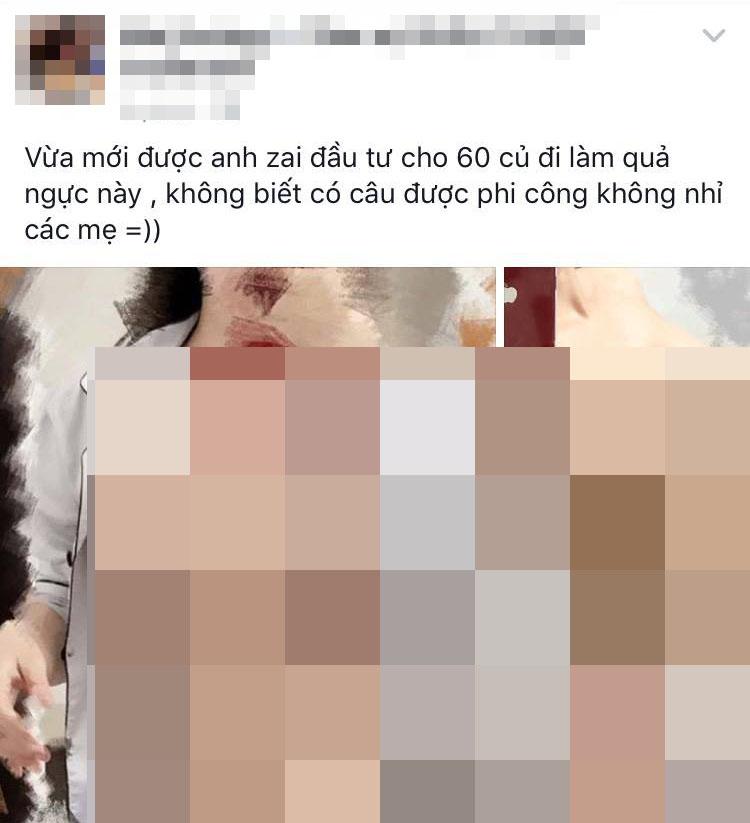 cho ban gai 60 trieu dong di sua vong 1, chang trai nhan ket dang hinh anh 2