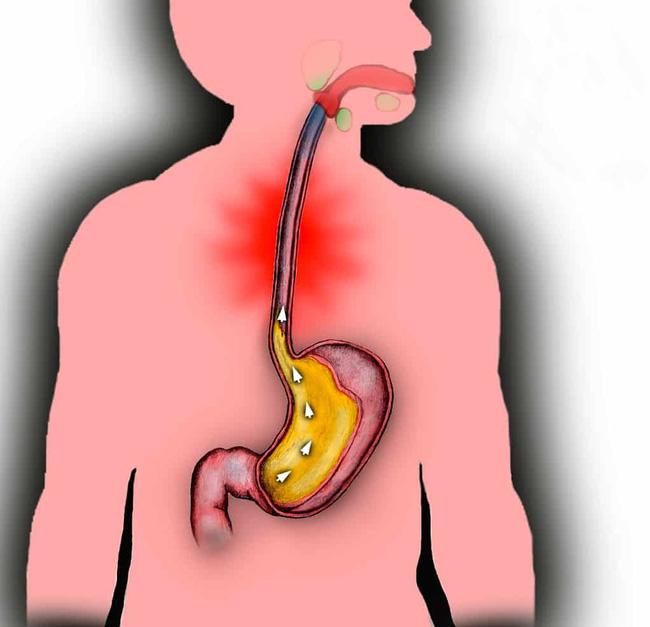 Cứ ngủ ngay sau khi ăn trưa, cẩn thận kẻo mắc các bệnh nguy hiểm này - Ảnh 2.