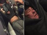 Ảnh hot trong tuần: Hành khách gốc Việt gãy mũi sau khi bị lôi thô bạo khỏi máy bay