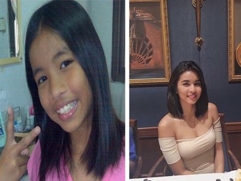 Thêm một màn dậy thì mỹ mãn của hot girl Philippines từng đen nhẻm và gầy gò