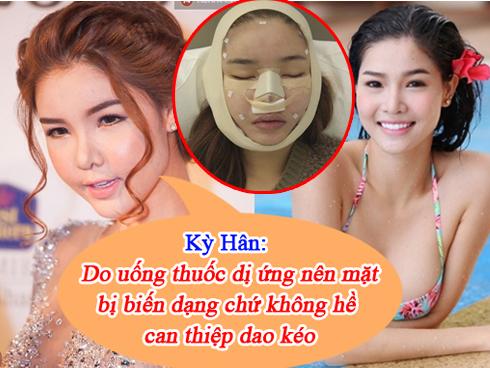 Những lý do 'trời ơi đất hỡi' của dàn mỹ nhân Việt mỗi khi bị nghi ngờ dao kéo thẩm mỹ