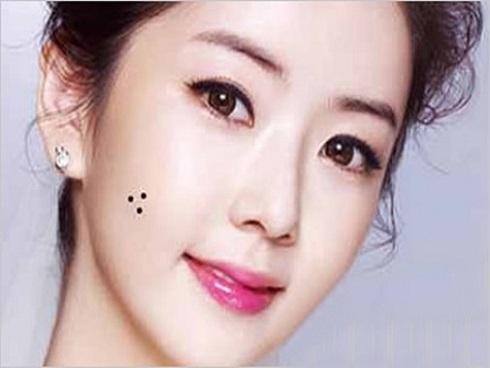 Giải mã bí mật tướng mạo có 3 nốt ruồi tạo thành hình tam giác