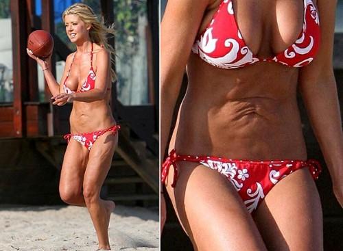 hang loat my nhan "hoi khong kip" boi nhan sac kinh di sau khi can thiep dao keo - 3