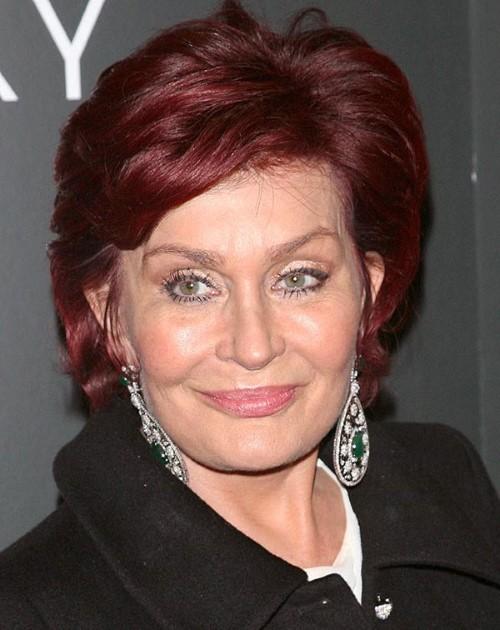 hang loat my nhan "hoi khong kip" boi nhan sac kinh di sau khi can thiep dao keo - 2