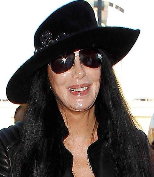 hang loat my nhan "hoi khong kip" boi nhan sac kinh di sau khi can thiep dao keo - 4