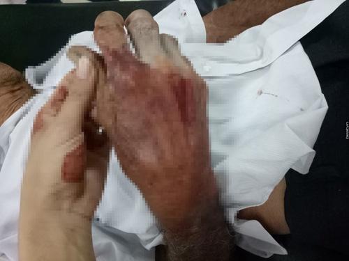 mac chau gai van xin, nguoi cau ruot khong ngung danh bo me gia yeu hon 80 tuoi - 5