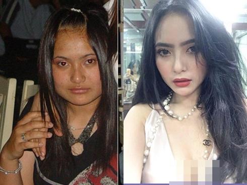 Sau tai nạn giao thông, cô gái Đà Lạt bất ngờ lột xác 'vạn người mê'
