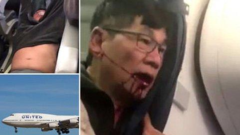 david dao, bác sĩ gốc Việt, bác sĩ bị lôi khỏi máy bay, United Airlines, bồi thường
