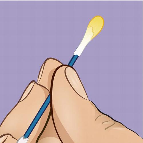 mau sac ray tai 'to cao' gi ve suc khoe cua ban? - 3