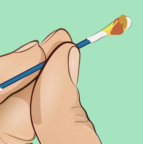 mau sac ray tai 'to cao' gi ve suc khoe cua ban? - 4