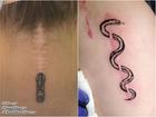 Góc tattoo: Hô biến những vết sẹo đáng ghét thành tác phẩm nghệ thuật