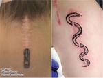 Góc tattoo: Hô biến những vết sẹo đáng ghét thành tác phẩm nghệ thuật