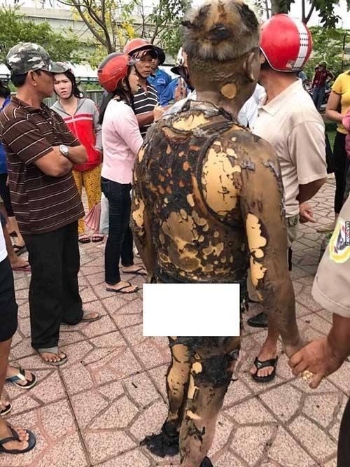 xon xao viec nguoi dan ong tu thieu vi con cai lam an vo no nhieu lan - 2