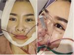 Quế Vân công khai clip phẫu thuật thẩm mỹ 6 bộ phận trên mặt khiến ai xem cũng shock