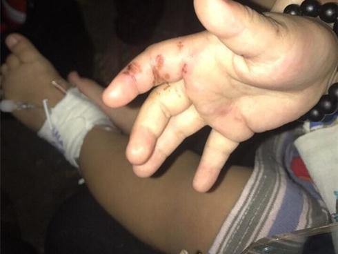 Người mẹ trẻ tiếp tay cho chồng hờ, bạo hành con trai 2 tuổi phải nhập viện cấp cứu?