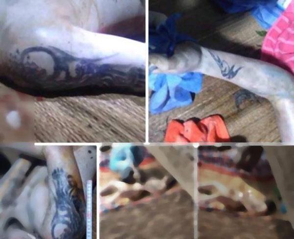 vu thi the bi cat "cua quy": vi sao nghi pham rach bung nan nhan? - 2