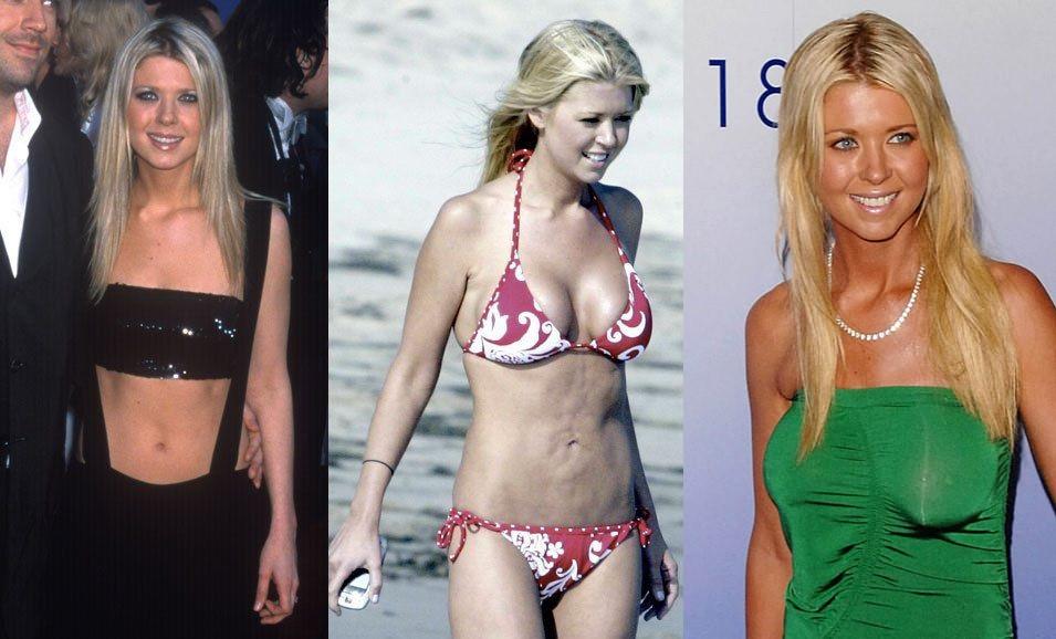 Vong mot xuong cap vi 'dao keo' hong cua cac ngoi sao Hollywood hinh anh 2