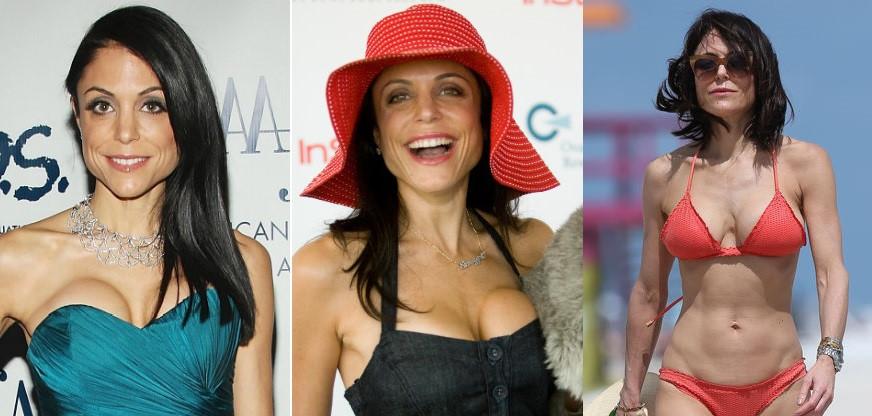 Vong mot xuong cap vi 'dao keo' hong cua cac ngoi sao Hollywood hinh anh 4