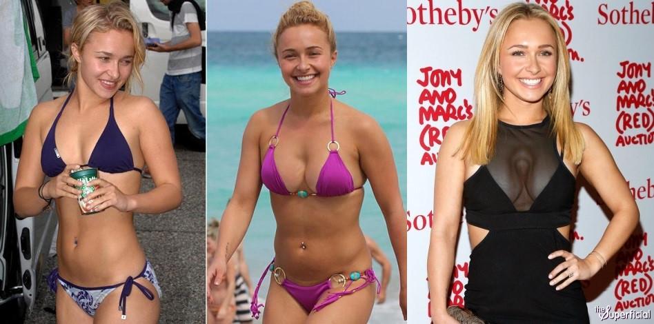 Vong mot xuong cap vi 'dao keo' hong cua cac ngoi sao Hollywood hinh anh 5