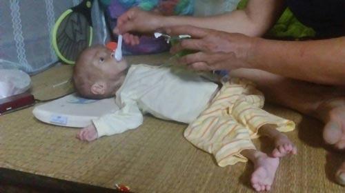 nuoc mat nguoi me co con mac benh ngay cang teo det, 4 tuoi nang 3.6kg - 4