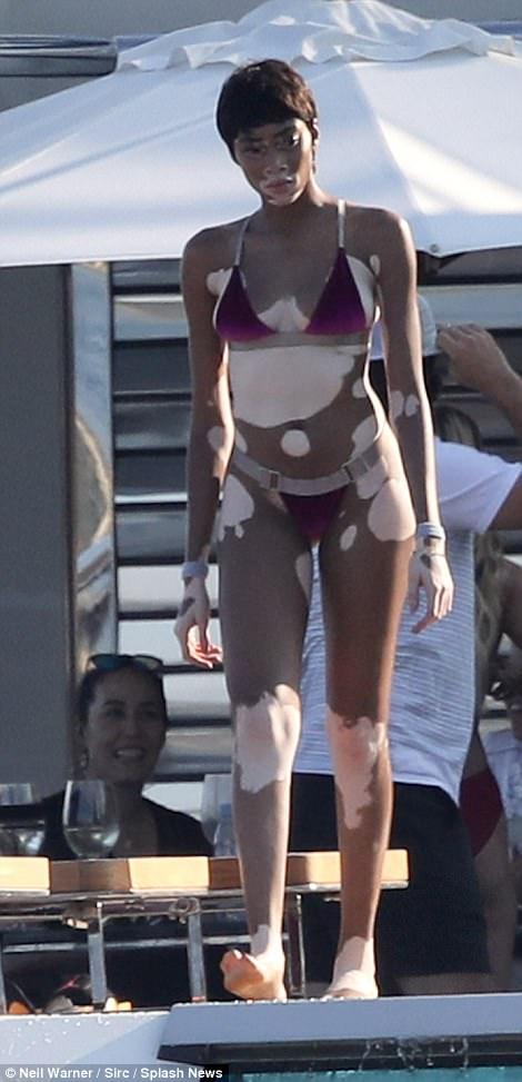Winnie Harlow mặc bikini khoe da loang lổ cạnh Bella Hadid - 2sao