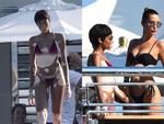 Người mẫu bạch biến mặc bikini khoe làn da loang lổ độc đáo, làm lu mờ cả Bella Hadid