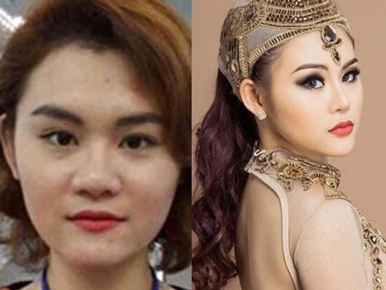 Chi 900 triệu dao kéo, hotgirl Bến Tre đẹp như nữ thần gây 'sốt mạng'