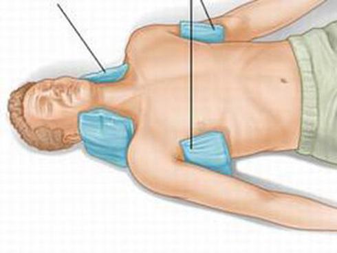 Cách sơ cứu người bị sốc nhiệt do nắng nóng