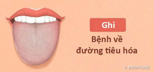 mau luoi noi len tinh trang suc khoe cua ban the nao? - 8