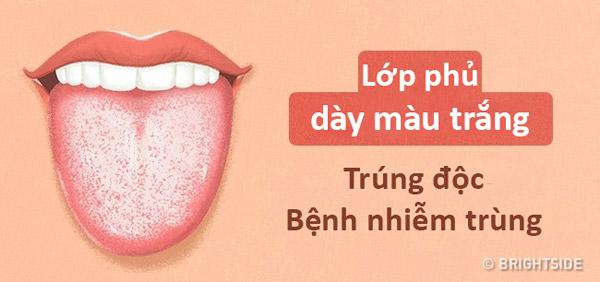 mau luoi noi len tinh trang suc khoe cua ban the nao? - 9