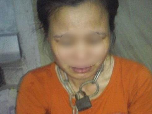 Thái Bình: Chồng dùng nhục hình xích cổ vợ, bẻ gãy tay con phải nhập viện